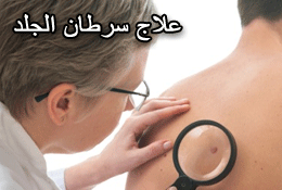 Treating skin cancer